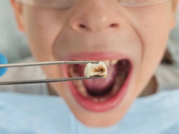 Best Weekend Emergency Dentist in Mcleansboro, IL