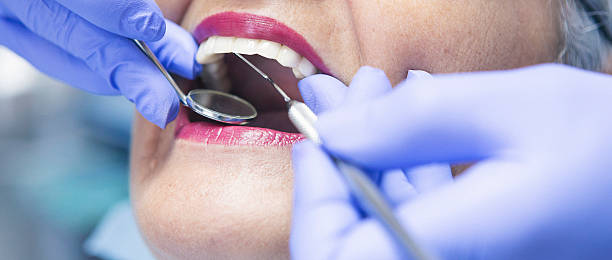 Best Cosmetic Emergency Dentistry in Mcleansboro, IL