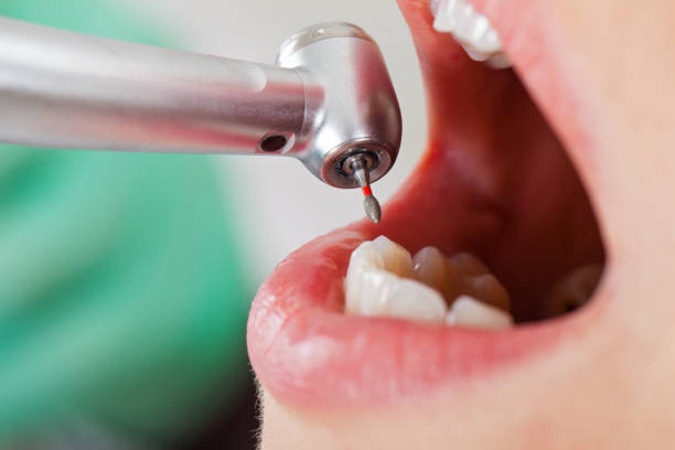 Best Emergency TMJ Treatment in Mcleansboro, IL